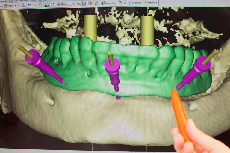 3D-Diagnostik Röntgenaufnahme