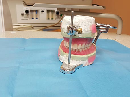 Zahnimplantate im Ausland setzen