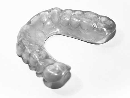 Aufbissschienen, Zahnschienen gegen Zähneknirschen