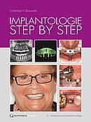 Buchcover Implantologie Step by Step