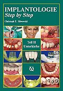 Buchcover Implantologie Step by Step - Teil II