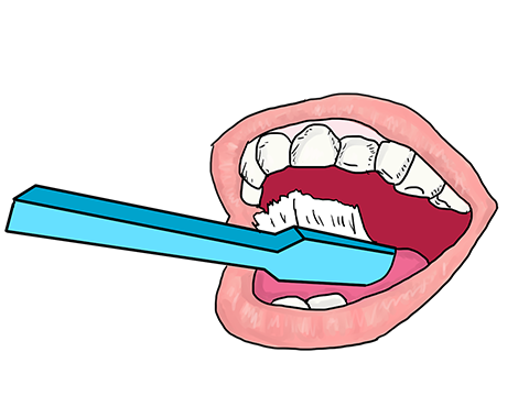 Zahnfleischerkrankungen