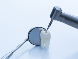 Stilleben auf glatter, sauberer Fläche, bestehend aus einem Zahn, einem Zahnarztspiegel und einem Bohrer, der gerade an dem Zahn bohrt.